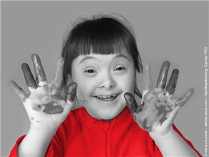 Mädchen zeigt lächelnd die bunt mit bemalten Handflächen in die Kamera. In Graustufen, Oberteil des Kindes rot. © denys-kuvaiev|stock.adobe.com|Bearb.Caritas FRG 