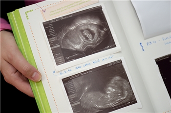 Ultraschallbilder eines ungeborenen Kindes
