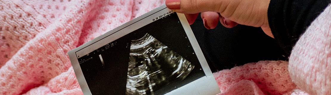 Frau mit Ultraschallbild
