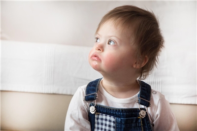Ein Kindergartenkind mit Down-Syndrom im Porträt.